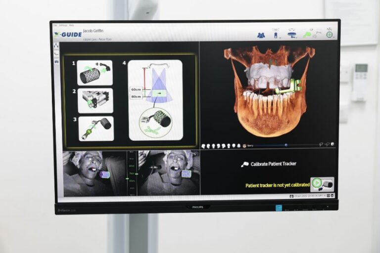 Implant planning software on screen for guided implant surgery